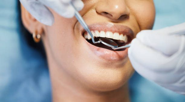 Best Emergency Treatment for Dental Infections or Abscesses in Pulaski, NY